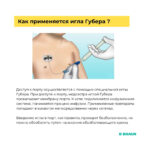 Игла Губера 22G/15mm (Сурекан/Surecan) с фикс. крыльями без Y-коннектора