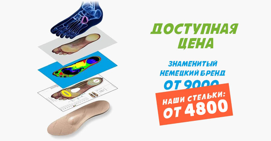ИЗГОТОВЛЕНИЕ ИНДИВИДУАЛЬНЫХ ОРТОПЕДИЧЕСКИХ СТЕЛЕК